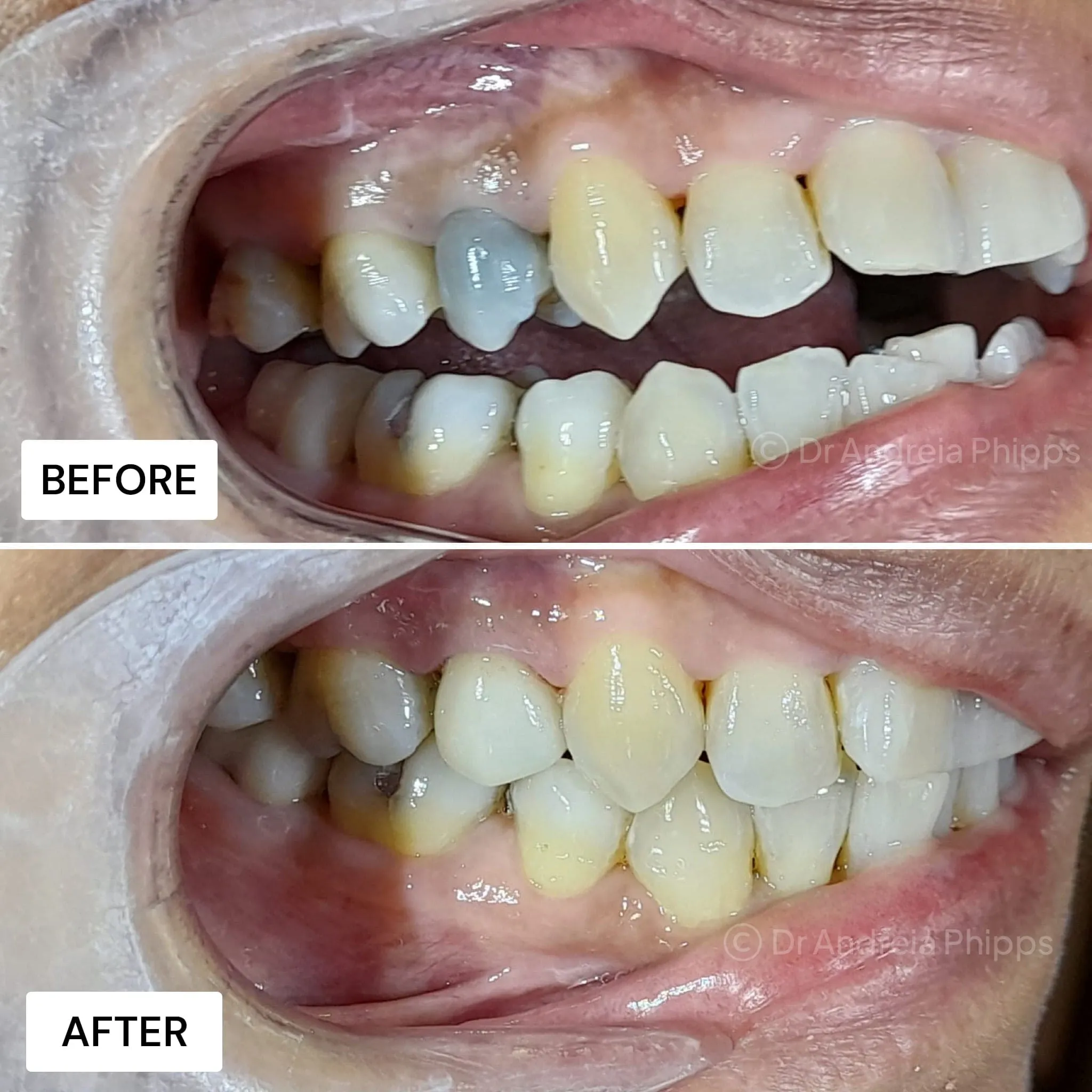 Smile transformation 8