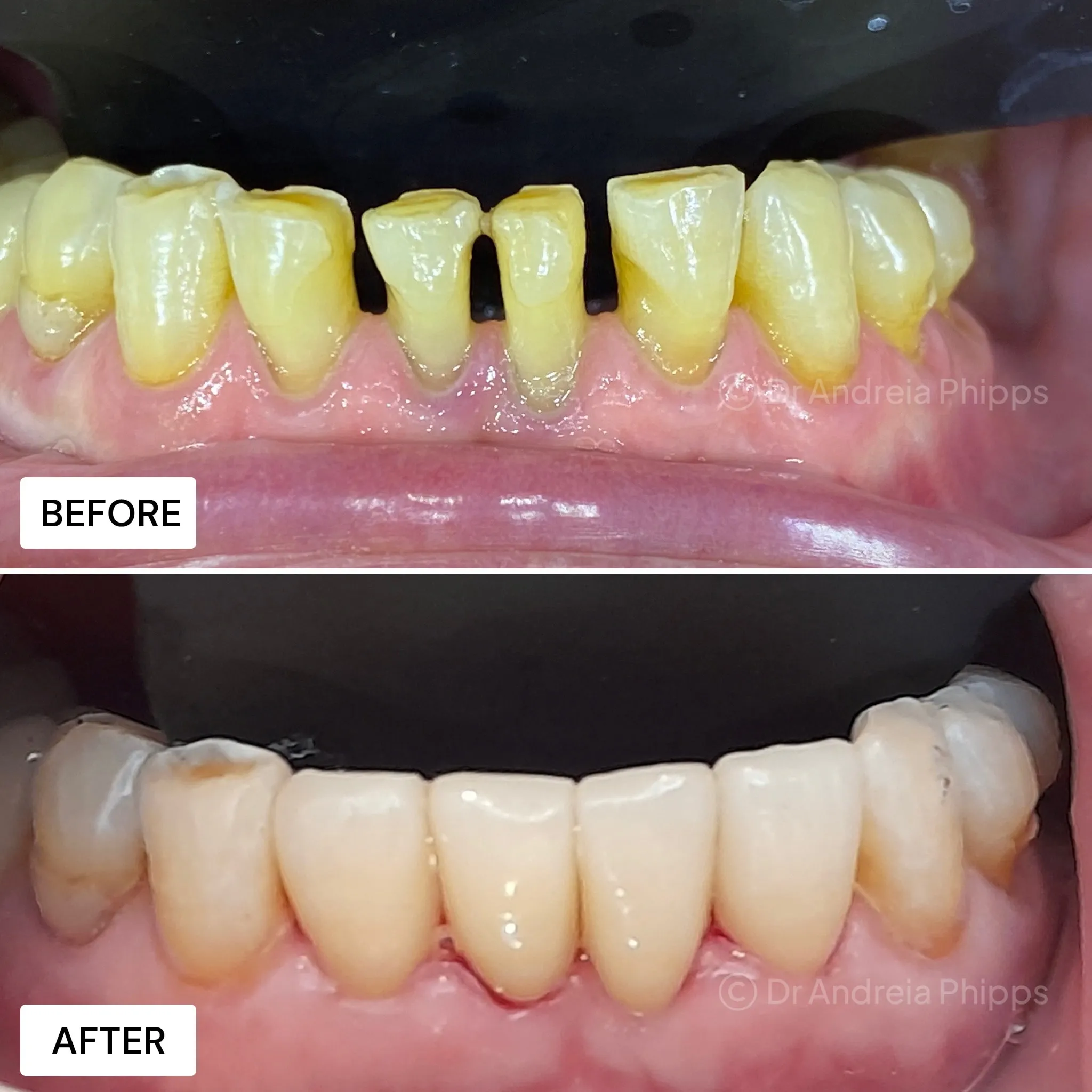 Smile transformation 7