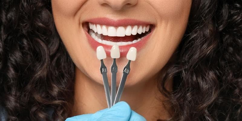 Dental Veneers and Crowns for Short or Worn Teeth