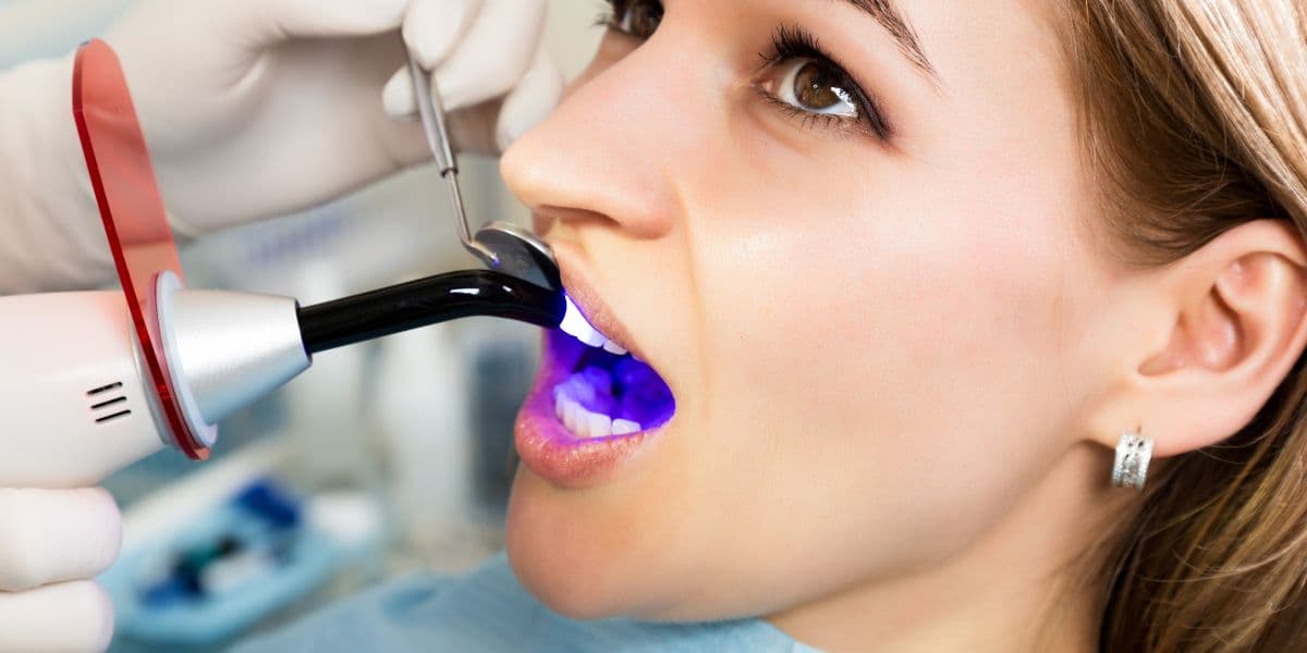 Composite bonding teeth — price, benefits and longevity guide by St Paul's Medical and Dental