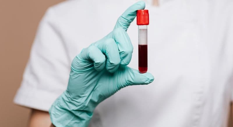 Why Routine Blood Analysis Is Essential for Early Health Detection